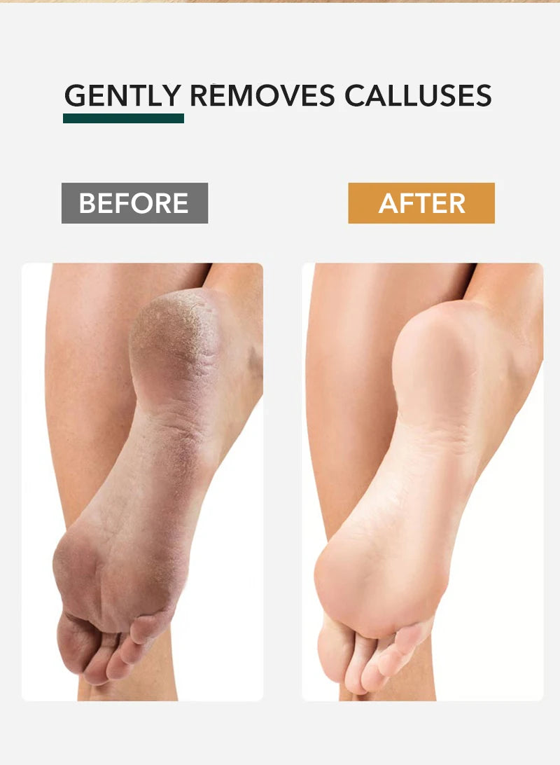 1PCS Professional Pedicure Rasp Tool for Dead Skin Crack Heels Beech Wood Foot File Rasp Callus Remover Foot Scrubber